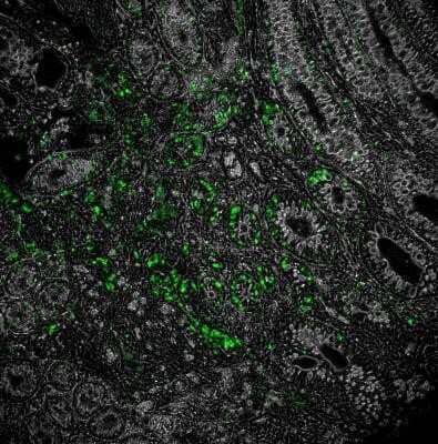 Immunohistochemistry: NOD2 Antibody (2D9) - Azide and BSA Free [NBP2-80883] - Overlay of NOD2-DyLight 488 (green) with phase contrast of murine colon. Image from verified customer review. Image from the standard format of this antibody.