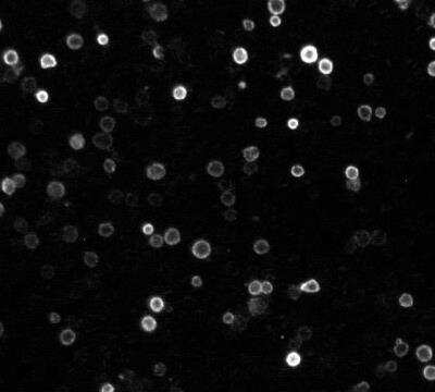 Immunocytochemistry/Immunofluorescence: NOD2 Antibody (2D9) [DyLight 488] [NB100-524G] - NOD2 was detected in human monocytes using NOD2 antibody (2D9) [DyLight 488]- with a concentration of 1:500 in PBS for 2 hours. Image from verified customer review.