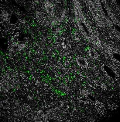 Immunohistochemistry-Frozen: NOD2 Antibody (2D9) [DyLight 488] [NB100-524G] - Overlay of NOD2-DyLight 488 (green) with phase contrast of murine colon.  Image for verified customer review.