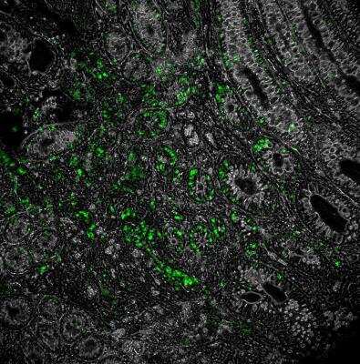 Immunohistochemistry-Frozen: NOD2 Antibody Pack [NB100-935] - Overlay of NOD2-DyLight 488 (NB100-524, green) with phase contrast of murine colon. Image from verified customer review.
