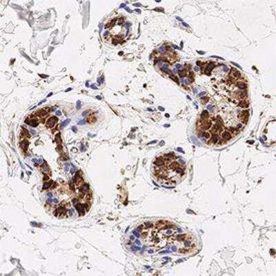 Immunohistochemistry-Paraffin: NOD2 Antibody Pack [NB100-935] - Analysis of FFPE human skin using NOD2 antibody (NB500-253) at 1:250 on a Bond Rx autostainer (Leica Biosystems). The assay involved 20 minutes of heat induced antigen retrieval (HIER) using 10 mM sodium citrate buffer (pH 6.0) and endogenous peroxidase quenching with peroxide block. The sections were incubated with primary antibody for 30 minutes and Bond Polymer Refine Detection (Leica Biosystems) with DAB was used for signal development followed by counterstaining with hematoxylin. Whole slide scanning and capturing of representative images was performed using Aperio AT2 (Leica Biosystems). Cytoplasmic staining of NOD2 was observed. Staining was performed by Histowiz.
