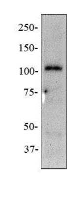 Western Blot: NOD2 Antibody Pack [NB100-935] - anti-NOD2 (2D9) Whole cell protein from THP-1 cells was separated on a 7.5% gel by SDS-PAGE, transferred to PVDF membrane and blocked in 5% non-fat milk in TBST. The membrane was probed with 2 ug/ml anti-NOD2 (NB100-524) in 1% milk, and detected with an anti-mouse HRP secondary antibody using chemiluminescence.