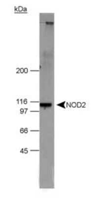 Western Blot: NOD2 Antibody [NB500-253] - Detection of NOD2 in 20 ug of NOD2 transfected 293T cell lysate using NB 500-253.  ECL detection in 15 seconds.