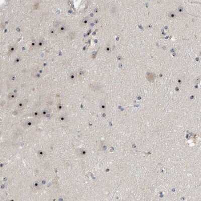 Immunohistochemistry-Paraffin: NOL11 Antibody [NBP1-90522] - Staining of human hippocampus shows strong nucleolar positivity in neuronal cells.