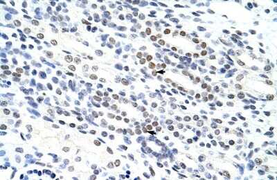 Immunohistochemistry-Paraffin: NOL4 Antibody [NBP1-57244] - Human kidney Tissue, antibody concentration 4-8ug/ml. Cells with positive label: renal corpuscle cells (indicated with arrows) 400X magnification.