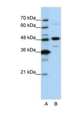Western Blot: NOL4 Antibody [NBP1-57244] - HepG2 cell lysate, Antibody Titration: 0.2-1 ug/ml