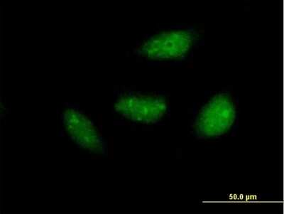 Immunocytochemistry/Immunofluorescence: NOL6 Antibody [H00065083-B01P] - Analysis of purified antibody to NOL6 on HeLa cell. (antibody concentration 10 ug/ml)
