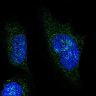 Immunocytochemistry/Immunofluorescence: NOL6 Antibody [NBP2-47353] - Immunofluorescent staining of human cell line U-2 OS shows localization to nucleus & nucleoli.