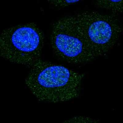Immunocytochemistry/Immunofluorescence: NOL6 Antibody [NBP2-57528] - Staining of human cell line A549 shows localization to nucleus & nucleoli.