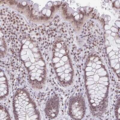 Immunohistochemistry: NOL6 Antibody [NBP2-47353] - Staining of human rectum shows moderate nuclear positivity in glandular cells.