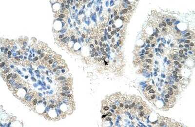 Immunohistochemistry-Paraffin: NOL6 Antibody [NBP1-57231] - Human Intestine Tissue, antibody concentration 4-8ug/ml. Cells with positive label: Epithelial cells of intestinal villus (indicated with arrows) 400X magnification.