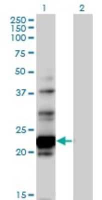 Western Blot: NOL6 Antibody [H00065083-B01P] - Analysis of NOL6 expression in transfected 293T cell line by NOL6 polyclonal antibody.  Lane 1: NOL6 transfected lysate(22.11 KDa). Lane 2: Non-transfected lysate.
