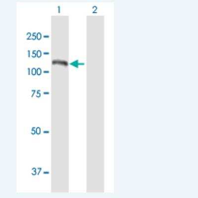 Western Blot: NOL6 Antibody [H00065083-B02P-50ug] - Analysis of NOL6 expression in transfected 293T cell line by NOL6 MaxPab polyclonal antibody.  Lane 1: NOL6 transfected lysate(125.73 KDa). Lane 2: Non-transfected lysate.