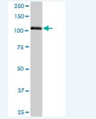 Western Blot: NOL6 Antibody [H00065083-B02P-50ug] - Analysis of NOL6 expression in human spleen.