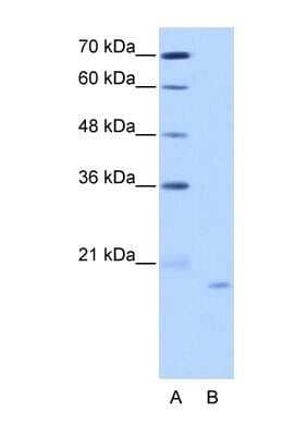 Western Blot NOL6 Antibody - BSA Free