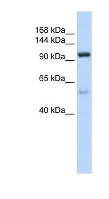 Western Blot: NOL6 Antibody [NBP1-57280] - 721_B cell lysate, concentration 0.2-1 ug/ml.