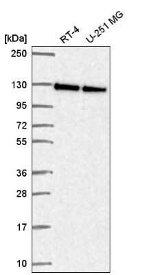 Western Blot NOL6 Antibody - BSA Free