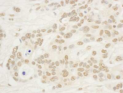 Immunohistochemistry NOL8 Antibody