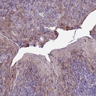 Immunohistochemistry-Paraffin: NOL8 Antibody [NBP1-92194] - Staining of human tonsil shows nucleolar positivity.