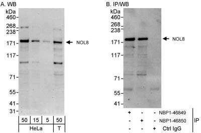 Western Blot: NOL8 Antibody [NBP1-46850] - Samples:  Whole cell lysate from HeLa (5, 15 and 50 ug for WB; 1 mg for IP, 20% of IP loaded) and 293T (T; 50 ug) cells.  Antibodies: Affinity purified rabbit anti-NOP132 antibody NBP1-46850 used for WB at 0.1 ug/ml (A) and 1 ug/ml (B) and used for IP at 3 ug/mg lysate.  NOP132 was also immunoprecipitated by rabbit anti-NOP132 antibody NBP1-46849, which recognizes an upstream epitope.  Detection: Chemiluminescence with exposure times of 30 seconds (A and B).