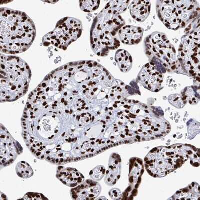 Immunohistochemistry-Paraffin NOLA1 Antibody