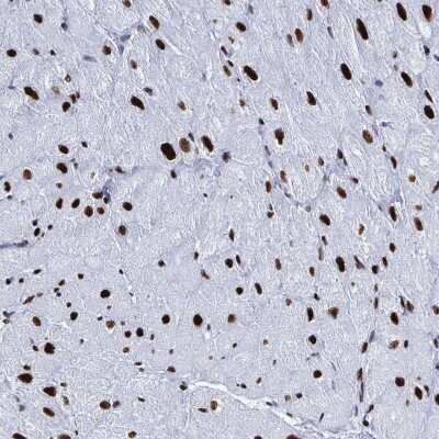 Immunohistochemistry-Paraffin: NOLA1 Antibody [NBP2-31742] - Staining of human heart muscle shows strong nuclear positivity in cardiomyocytes.