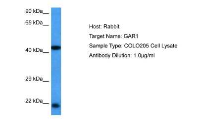 Western Blot: NOLA1 Antibody [NBP2-85392] - Host: Rabbit. Target Name: GAR1. Sample Tissue: Human COLO205 Whole Cell lysates. Antibody Dilution: 1ug/ml