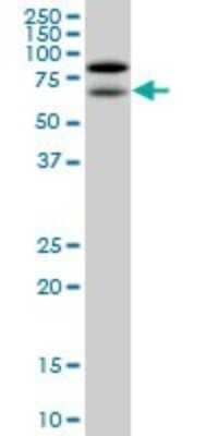 Western Blot: NOLC1 Antibody (3F8) [H00009221-M01] - NOLC1 monoclonal antibody (M01), clone 3F8. Analysis of NOLC1 expression in HepG2.