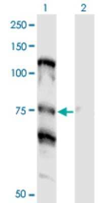 Western Blot: NOLC1 Antibody (3F8) [H00009221-M01] - Analysis of NOLC1 expression in transfected 293T cell line by NOLC1 monoclonal antibody (M01), clone 3F8.Lane 1: NOLC1 transfected lysate (Predicted MW: 73.7 KDa).Lane 2: Non-transfected lysate.