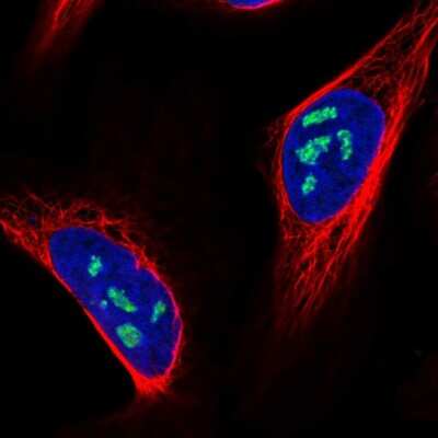 Immunocytochemistry/Immunofluorescence: NOLC1 Antibody [NBP1-83058] - Immunofluorescent staining of human cell line U-2 OS shows localization to nucleoli.