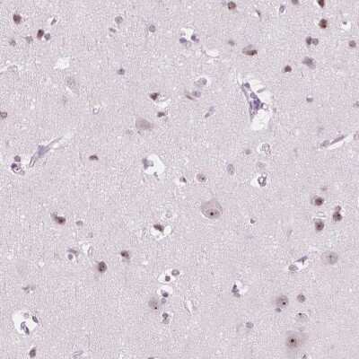 Immunohistochemistry: NOLC1 Antibody [NBP2-38625] - Staining of human cerebral cortex shows moderate nucleolar positivity in neuronal cells.