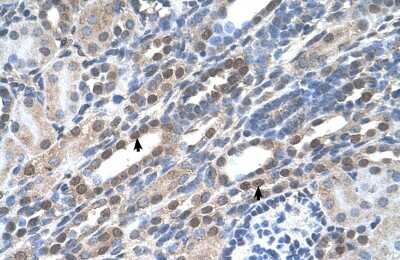 Immunohistochemistry-Paraffin: NOLC1 Antibody [NBP1-58200] - Human kidney Tissue, antibody concentration 4-8ug/ml. Cells with positive label: renal corpuscle cells (indicated with arrows) 400X magnification.