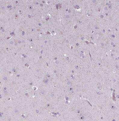 Immunohistochemistry-Paraffin: NOLC1 Antibody [NBP1-83058] - Staining of human cerebral cortex shows moderate nucleolar positivity in neuronal cells.