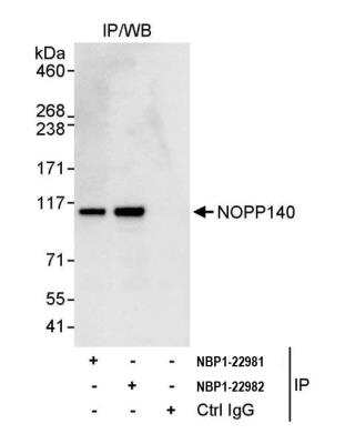 <b>Independent Antibodies Validation. </b>Immunoprecipitation: NOLC1 Antibody [NBP1-22981] - Detection of human NOPP140 by western blot of immunoprecipitates. Samples: Whole cell lysate (1 mg for IP, 20% of IP loaded) from K-562 cells. Antibodies: Affinity purified rabbit anti-NOPP140 antibody NBP1-22981 used for IP at 3 ug/mg lysate. NOPP140 was also immunoprecipitated by rabbit anti-NOPP140 antibody NBP1-22982, which recognizes a downstream epitope. For blotting immunoprecipitated NOPP140, NBP1-22981 was used at 1 ug/ml. Detection: Chemiluminescence with an exposure time of 3 seconds.