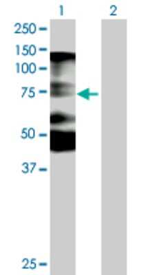 Western Blot: NOLC1 Antibody [H00009221-B01P] - Analysis of NOLC1 expression in transfected 293T cell line by NOLC1 polyclonal antibody.  Lane 1: NOLC1 transfected lysate(77 KDa). Lane 2: Non-transfected lysate.