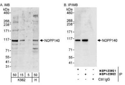 Western Blot: NOLC1 Antibody [NBP1-22982] - Whole cell lysate from K562 (5, 15 and 50 mcg for WB; 1 mg for IP, 20% of IP loaded) and HeLa (H; 50 mcg) cells.  Affinity purified rabbit anti- NOPP140 antibody  used for WB at 0.04 mcg/ml (A) and 1 mcg/ml (B) and used for IP at 3 mcg/mg lysate. NOPP140 was also immunoprecipitated by rabbit anti-NOPP140 antibody NBP1-22981, which recognizes an upstream epitope.