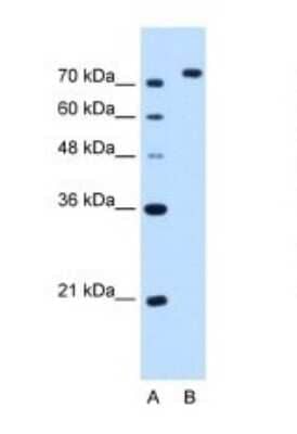 Western Blot: NOLC1 Antibody [NBP1-58200] - NOLC1 antibody - C-terminal region validated by WB using HepG2 cell lysate at 2.5ug/ml.