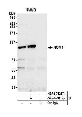Immunoprecipitation: NOM1 Antibody [NBP2-76357] - Detection of human NOM1 by western blot of immunoprecipitates. Samples: Whole cell lysate (1.0 mg per IP reaction; 20% of IP loaded) from HEK293T cells prepared using NETN lysis buffer. Antibodies: Affinity purified rabbit anti-NOM1 antibody NBP2-76357 used for IP at 100 ul per reaction. NOM1 was also immunoprecipitated by another rabbit anti-NOM1 antibody. For blotting immunoprecipitated NOM1, NBP2-76357 was used at 1:1000. Detection: Chemiluminescence with an exposure time of 10 seconds.