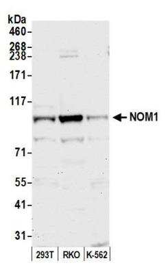 Western Blot: NOM1 Antibody [NBP2-76357] - Samples: Whole cell lysate (50 ug) from HEK293T, RKO, and K-562 cells prepared using NETN lysis buffer. Antibody: Affinity purified rabbit anti-NOM1 antibody NBP2-76357 used for WB at 1:1000. Detection: Chemiluminescence with an exposure time of 30 seconds.