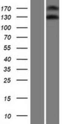 Western Blot: NOMO3 Overexpression Lysate (Adult Normal) [NBP2-08928] Left-Empty vector transfected control cell lysate (HEK293 cell lysate); Right -Over-expression Lysate for NOMO3.