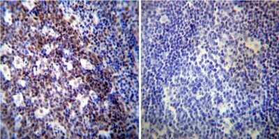 Immunohistochemistry-Paraffin: NONO Antibody (78-1 C) [NB100-74478] - Both normal and cancer biopsies of deparaffinized human Tonsil tissue.