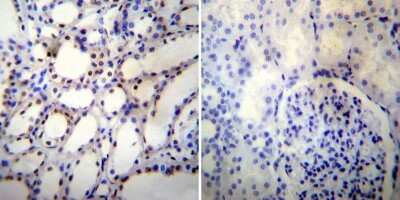 Immunohistochemistry-Paraffin: NONO Antibody (78-1 C) [NB100-74478] - Both normal and cancer biopsies of deparaffinized human Kidney tissue.