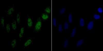 Immunocytochemistry/Immunofluorescence: NONO Antibody (JG87-38) [NBP2-75596] - Staining p54nrb in SiHa cells (green). The nuclear counter stain is DAPI (blue). Cells were fixed in paraformaldehyde, permeabilised with 0.25% Triton X100/PBS.