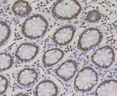 Immunohistochemistry-Paraffin: NONO Antibody (JG87-38) [NBP2-75596] - Analysis of paraffin-embedded human colon tissue using anti- p54nrb antibody. Counter stained with hematoxylin.