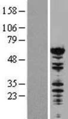 Western Blot: NONO Overexpression Lysate (Adult Normal) [NBP2-09747] Left-Empty vector transfected control cell lysate (HEK293 cell lysate); Right -Over-expression Lysate for NONO.