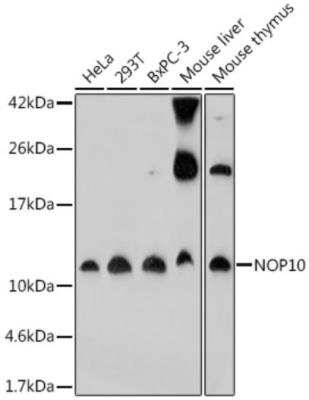 Western Blot: NOP10 Antibody [NBP2-93614] - Western blot analysis of extracts of various cell lines, using NOP10 at 1:1000 dilution. Secondary antibody: HRP Goat Anti-Rabbit IgG (H+L) at 1:10000 dilution. Lysates/proteins: 25ug per lane. Blocking buffer: 3% nonfat dry milk in TBST. Detection: ECL Basic Kit. Exposure time: 3min.