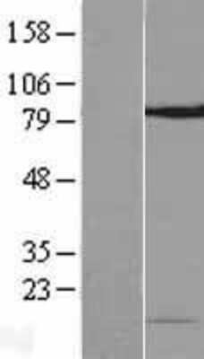 Western Blot NOP10 Overexpression Lysate