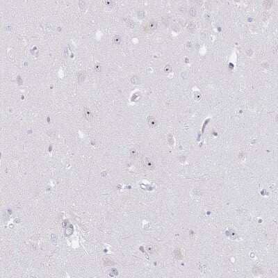 Immunohistochemistry-Paraffin NOP14 Antibody