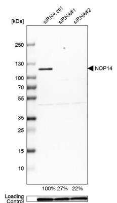 Western Blot NOP14 Antibody