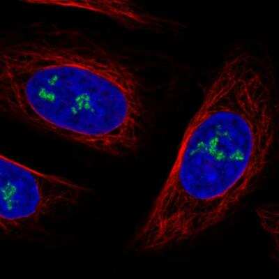 Immunocytochemistry/Immunofluorescence: NOP56 Antibody (CL2603) [NBP2-36778] - Staining in U2OS cell line with Anti-NOP56 monoclonal antibody, showing nucleoli-specific staining in green. Microtubule-staining and nuclear probes are visualized in red and blue respectively (where available). Antibody staining is shown in green.